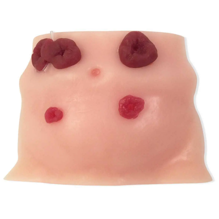 Ostomy Care Products